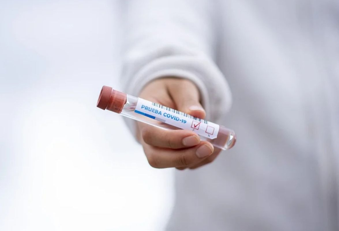 Тесты на коронавирус «ошибаются» до 40% случаев