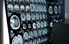 Сканы мозга не позволяют выявить поведение человека