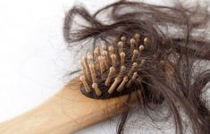 Постковидный синдром проявляется выпадением волос и снижением либидо